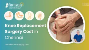 Knee Replacement Surgery Cost in Chennai