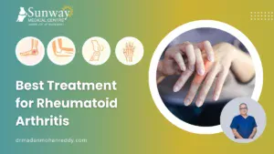 Best Treatment for Rheumatoid Arthritis