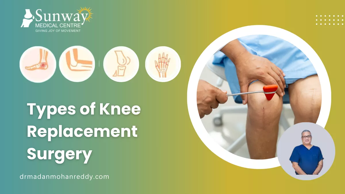 Types of Knee Replacement Surgery