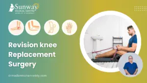 revision knee replacement surgery