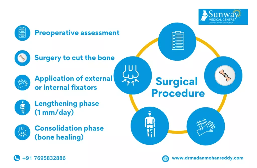 Limb Lengthening Surgery in Chennai